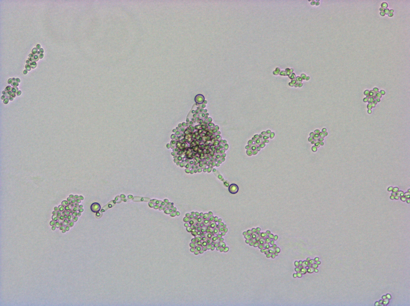 Der Einfluß der Qualität des Agars auf die Haemolyse in den Kulturen von Candida albicans